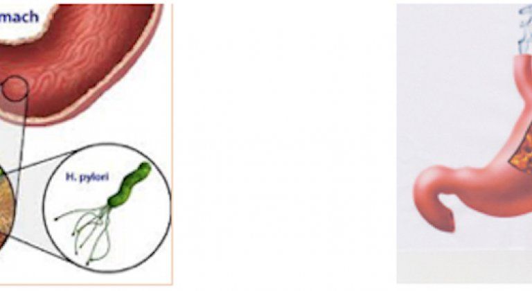 Screen Shot 2017-07-22 at 15.10.48 Screen Shot 2017-07-22 at 15.10.48